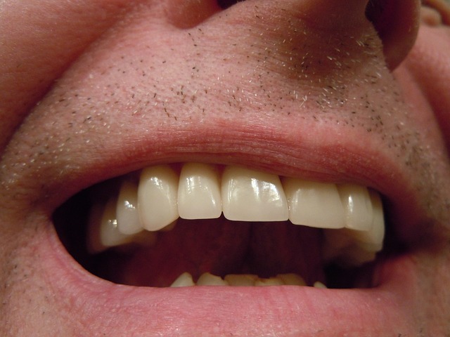 Dental Implants up close